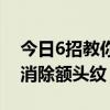 6招教你如何消除额头纹  教你如何消除抬头纹